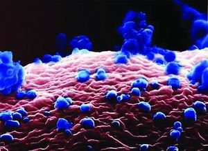 瑞士摄影师利用高倍显微镜，拍出H5N1禽流感病毒特写 