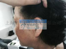 上海西门子助听器专卖店