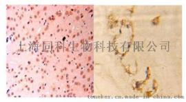 免疫组化/组织芯片检测（IHC）技术服务, 同科生物