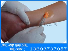亚都实业 一次性使用无菌碘伏棉球 中号