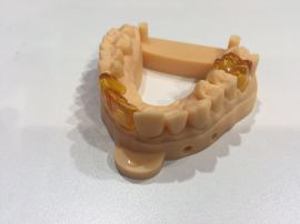 数字化口腔技术与3D打印牙齿的应用结合