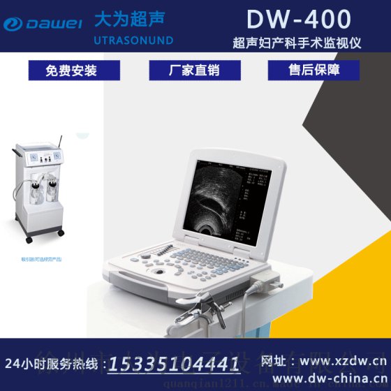 厂家直供可视人流机/超声妇产科手术监视仪/超导可视无痛人流系统