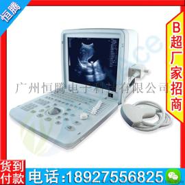 兽用b超机 A2型便携式b超  AloftAce牌彩色b超 猪羊b超机 兽用b超机 A2型便携式b超  AloftAce牌彩色b超 猪羊b超机